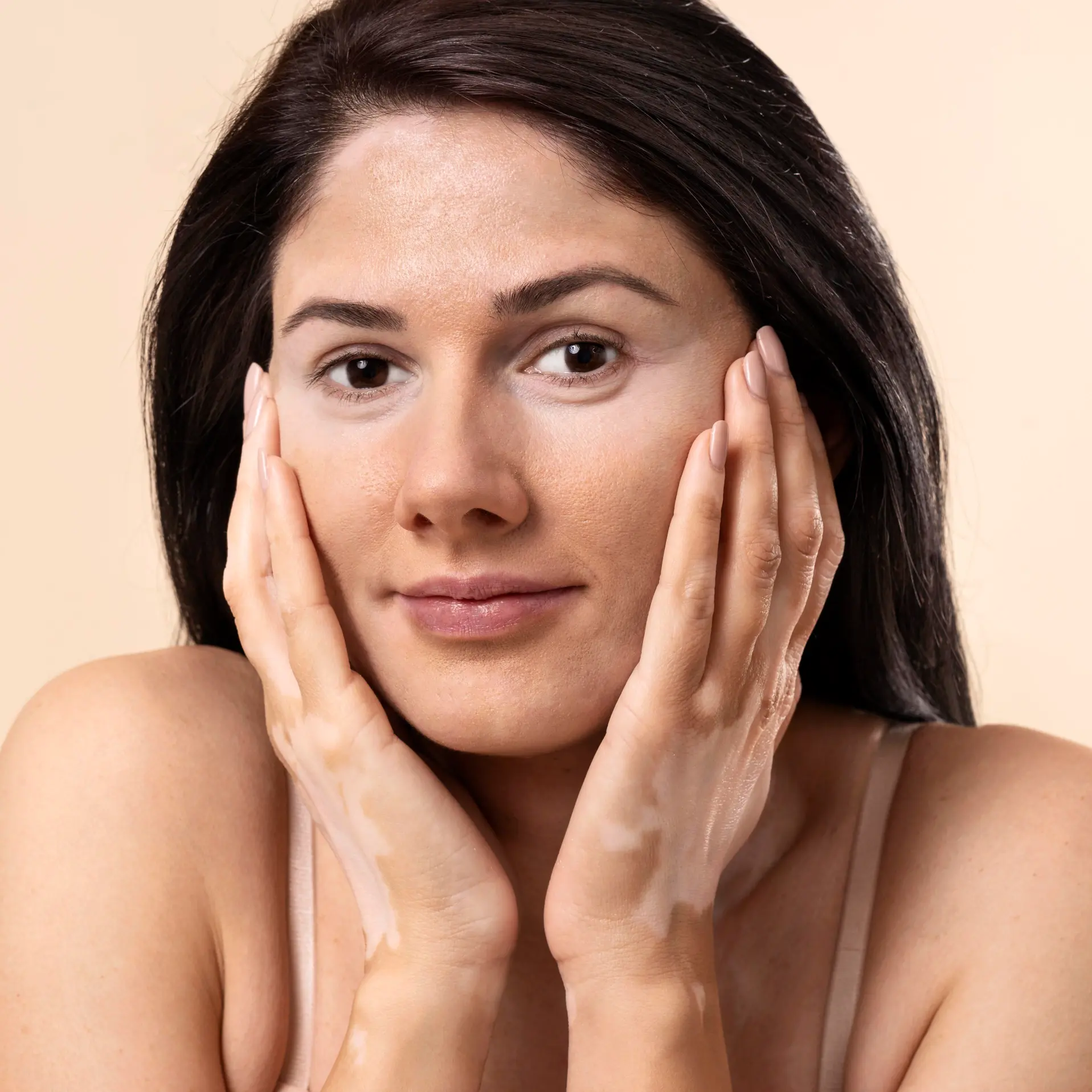 Pigmentation Treatment