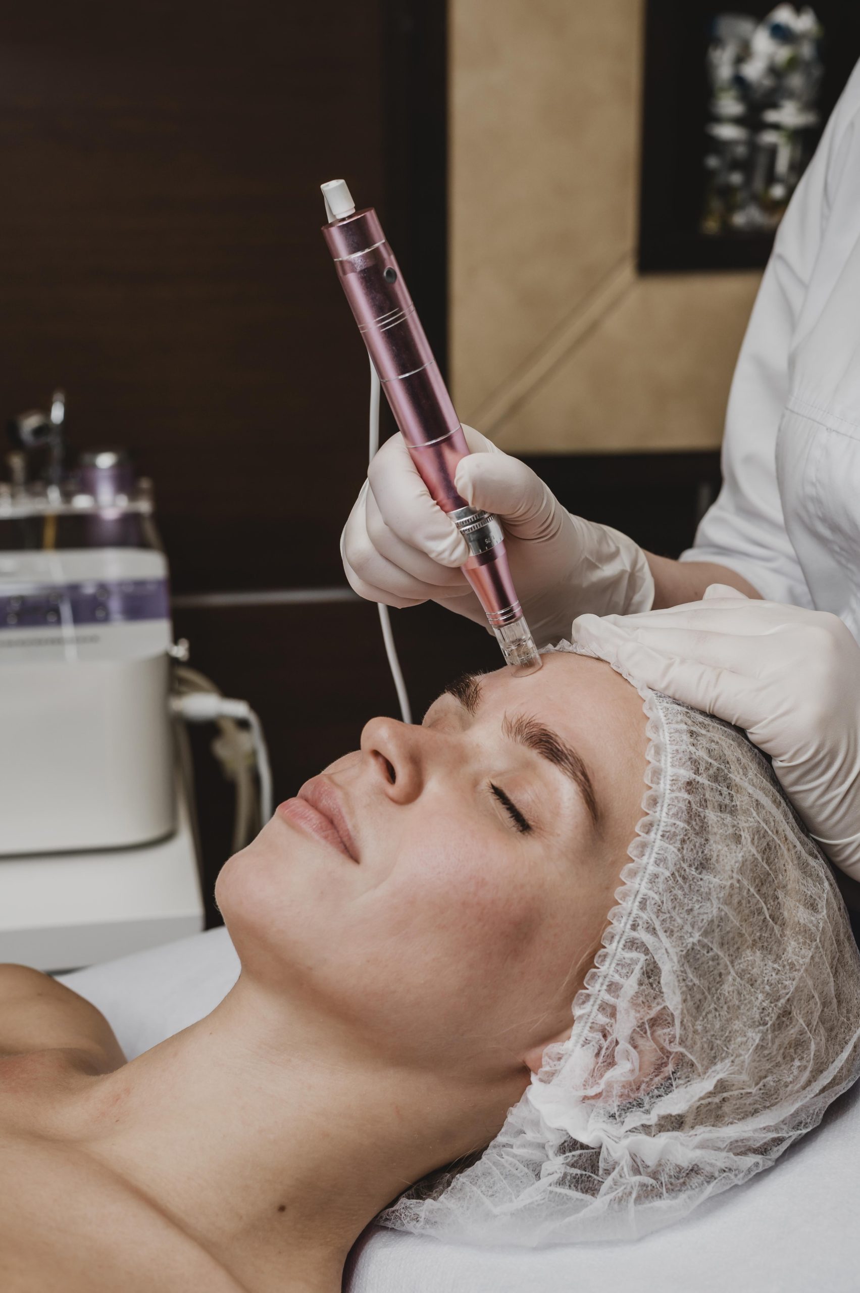 Micro needling