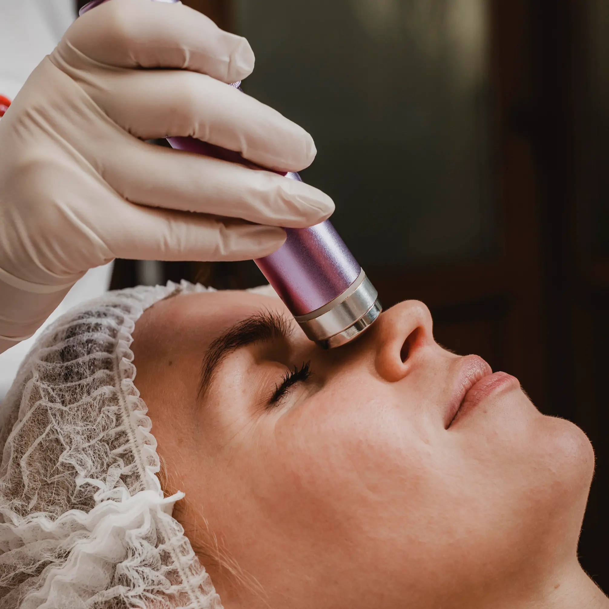 Microneedling